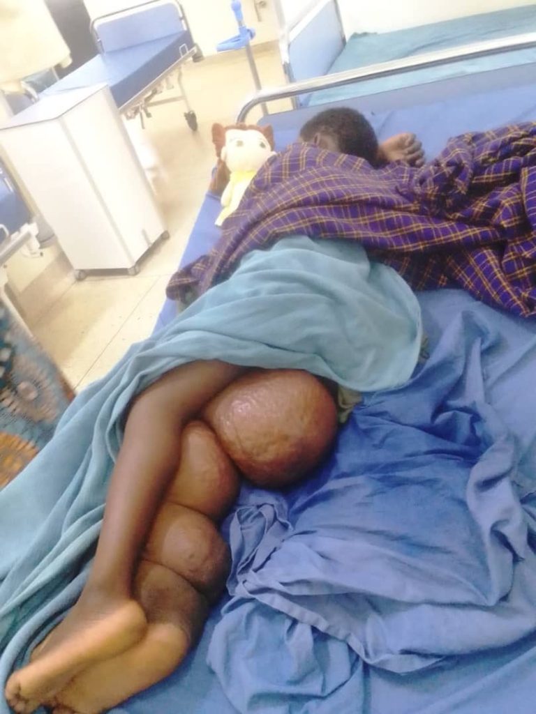 Rwanda: Umubare muto w’inzobere mu buvuzi uhangayikishije abarwaye n’abarwaje igihe kirekire